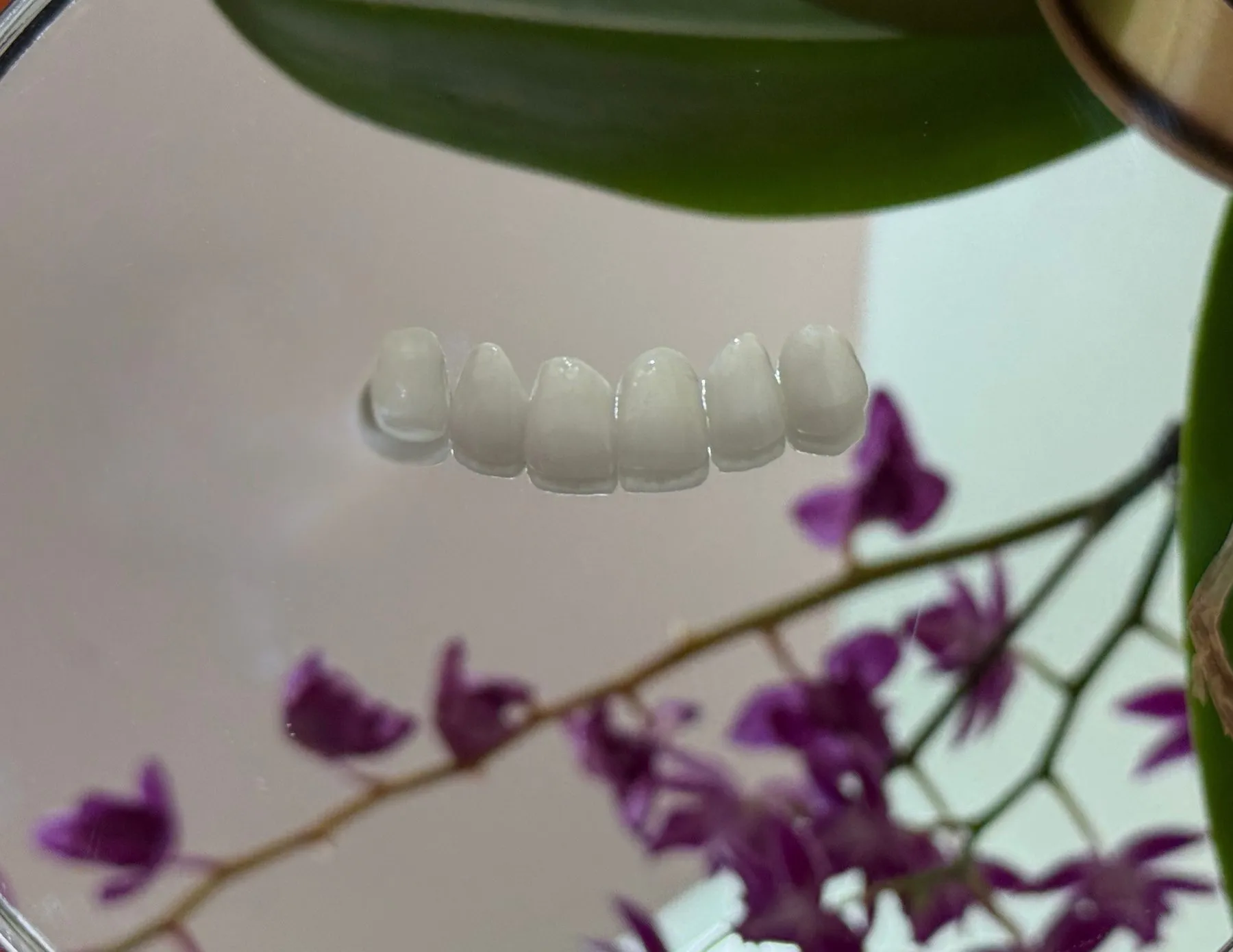 Porcelain veneer shells from Smiles By Dr. Cecile, showing the natural tooth shape and shade used for veneer cases
